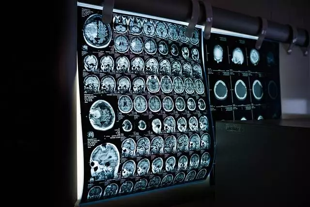 Was macht ein Neurologe?